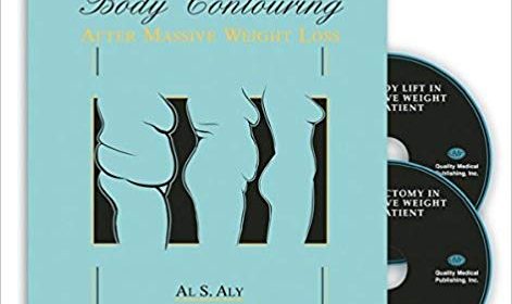 free-pdf-download-Body Contouring after Massive Weight Loss 1st Edition