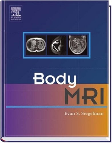 free-pdf-download-Body MRI