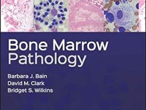 free-pdf-download-Bone Marrow Pathology