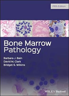 free-pdf-download-Bone Marrow Pathology