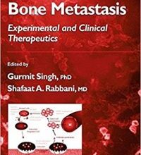 free-pdf-download-Bone Metastasis (Cancer Drug Discovery and Development) Softcover reprint of hardcover 1st ed