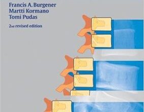 free-pdf-download-Bone and Joint Disorders (Differential Diagnosis in Conventional Radiology) 2nd Edition