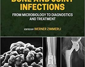 free-pdf-download-Bone and Joint Infections: From Microbiology to Diagnostics and Treatment 2nd Edition