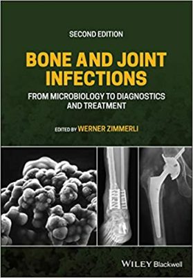 free-pdf-download-Bone and Joint Infections: From Microbiology to Diagnostics and Treatment 2nd Edition