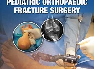 free-pdf-download-Boston Children’s Illustrated Tips and Tricks in Pediatric Orthopaedic Fracture Surgery