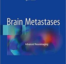 free-pdf-download-Brain Metastases: Advanced Neuroimaging 1st ed. 2018 Edition