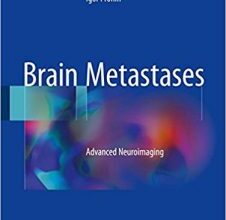 free-pdf-download-Brain Metastases: Advanced Neuroimaging 1st ed. 2018 Edition