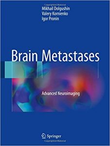 free-pdf-download-Brain Metastases: Advanced Neuroimaging 1st ed. 2018 Edition