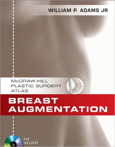 free-pdf-download-Breast Augmentation (McGraw-Hill Plastic Surgery Atlas) 1st Edition