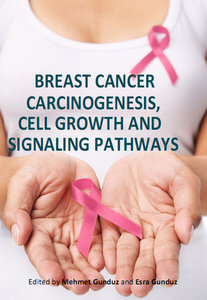 free-pdf-download-Breast Cancer: Carcinogenesis