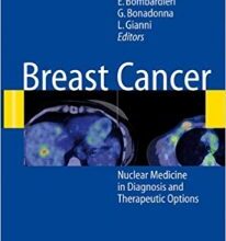 free-pdf-download-Breast Cancer: Nuclear Medicine in Diagnosis and Therapeutic Options