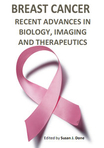 free-pdf-download-Breast Cancer: Recent Advances in Biology