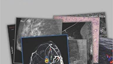 free-pdf-download-Breast Imaging (Radcases)