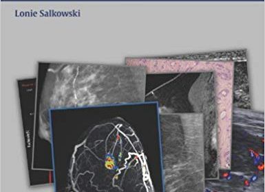 free-pdf-download-Breast Imaging (Radcases)