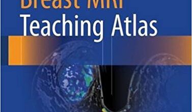 free-pdf-download-Breast MRI Teaching Atlas 1st ed. 2017 Edition