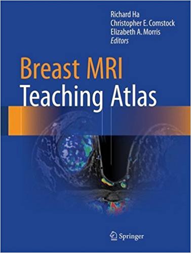 free-pdf-download-Breast MRI Teaching Atlas 1st ed. 2017 Edition