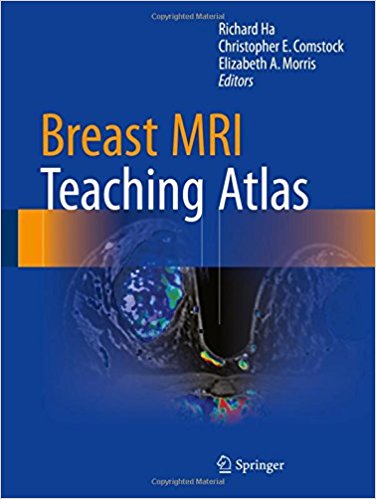 free-pdf-download-Breast MRI Teaching Atlas 1st ed. 2017 Edition