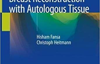 free-pdf-download-Breast Reconstruction with Autologous Tissue 1st ed