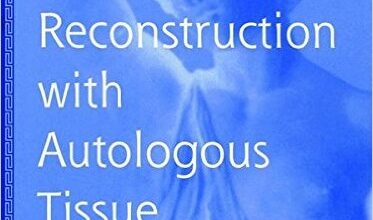 free-pdf-download-Breast Reconstruction with Autologous Tissue: Art and Artistry (Graduate Textbook)