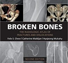 free-pdf-download-Broken Bones: The Radiologic Atlas of Fractures and Dislocations 2nd Edition