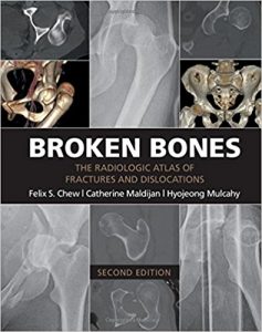 free-pdf-download-Broken Bones: The Radiologic Atlas of Fractures and Dislocations 2nd Edition