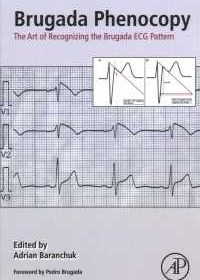 free-pdf-download-Brugada Phenocopy: The Art of Recognizing the Brugada ECG Pattern 1st Edition