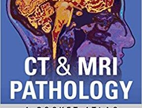 free-pdf-download-CT & MRI Pathology: A Pocket Atlas