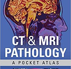 free-pdf-download-CT & MRI Pathology: A Pocket Atlas