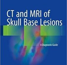 free-pdf-download-CT and MRI of Skull Base Lesions: A Diagnostic Guide 1st ed. 2018 Edition