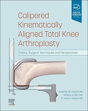 free-pdf-download-Calipered Kinematically aligned Total Knee Arthroplasty