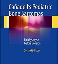 free-pdf-download-Cañadell’s Pediatric Bone Sarcomas: Epiphysiolysis before Excision