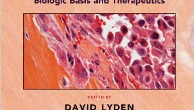 free-pdf-download-Cancer Metastasis: Biologic Basis and Therapeutics 1st Edition