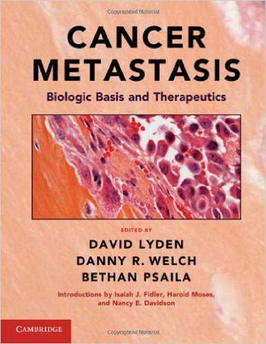 free-pdf-download-Cancer Metastasis: Biologic Basis and Therapeutics 1st Edition