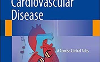 free-pdf-download-Cancer and Cardiovascular Disease: A Concise Clinical Atlas 1st ed. 2018 Edition