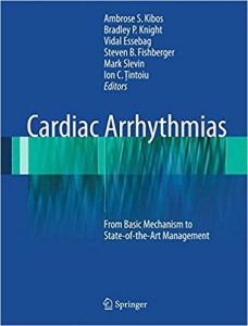 free-pdf-download-Cardiac Arrhythmias: From Basic Mechanism to State-of-the-Art Management 2014th Edition