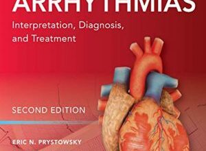 free-pdf-download-Cardiac Arrhythmias: Interpretation