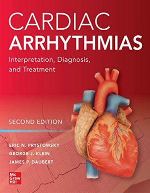 free-pdf-download-Cardiac Arrhythmias: Interpretation