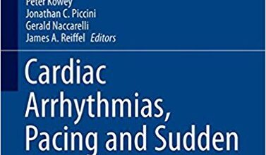 free-pdf-download-Cardiac Arrhythmias