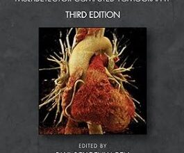 free-pdf-download-Cardiac CT Made Easy: An Introduction to Cardiovascular Multidetector Computed Tomography 3rd Edition