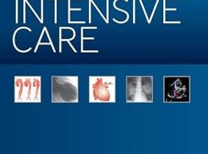 free-pdf-download-Cardiac Intensive Care 3rd Edition