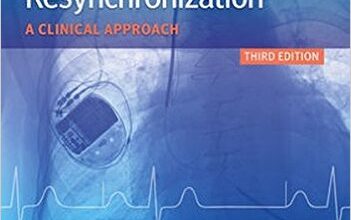 free-pdf-download-Cardiac Pacing