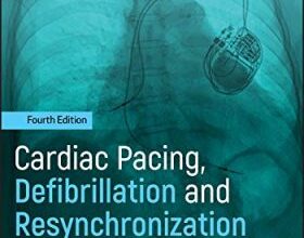 free-pdf-download-Cardiac Pacing