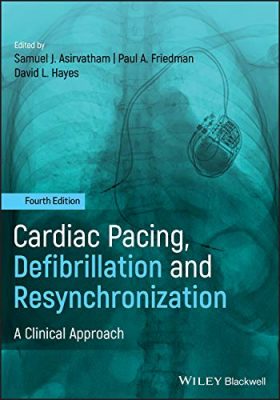 free-pdf-download-Cardiac Pacing