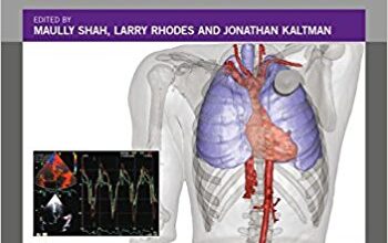 free-pdf-download-Cardiac Pacing and Defibrillation in Pediatric and Congenital Heart Disease 1st Edition