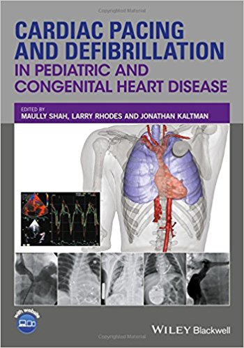 free-pdf-download-Cardiac Pacing and Defibrillation in Pediatric and Congenital Heart Disease 1st Edition