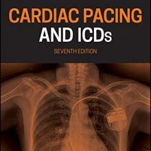 free-pdf-download-Cardiac Pacing and ICDs