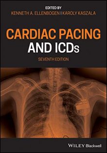 free-pdf-download-Cardiac Pacing and ICDs