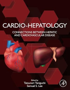 free-pdf-download-Cardio-Hepatology: Connections Between Hepatic and Cardiovascular Disease 1st Edition