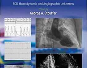 free-pdf-download-Cardiology Board Review: ECG