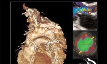 free-pdf-download-Cardiovascular Imaging